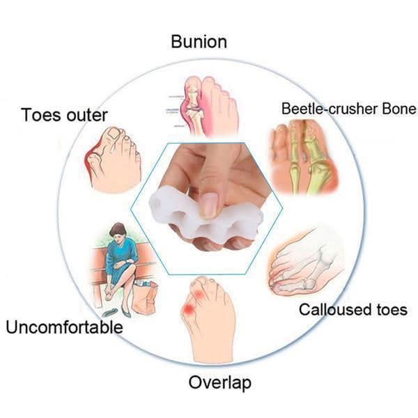 POSTUREFLOW – Foot Corrector for Balanced Toe Position Support