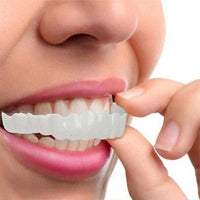 SMILEDURA – Upper and Lower Smile Veneer Set