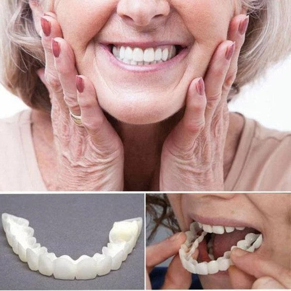 SMILEDURA – Upper and Lower Smile Veneer Set