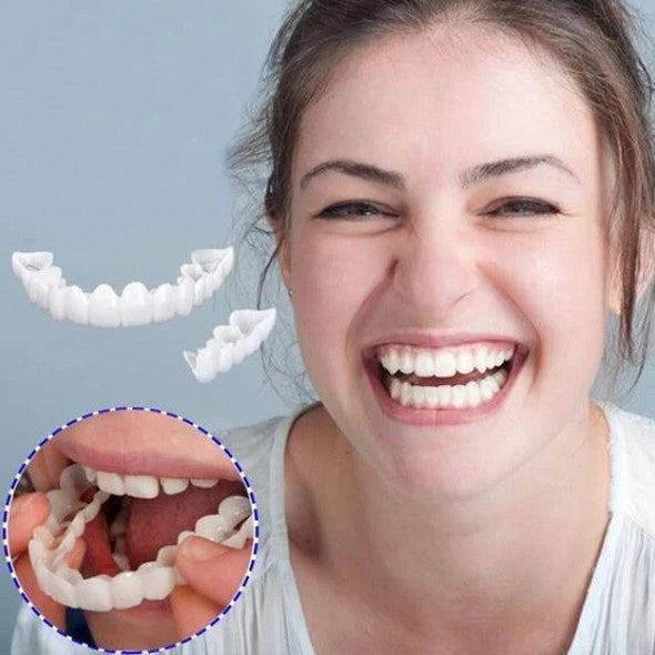 SMILEDURA – Upper and Lower Smile Veneer Set