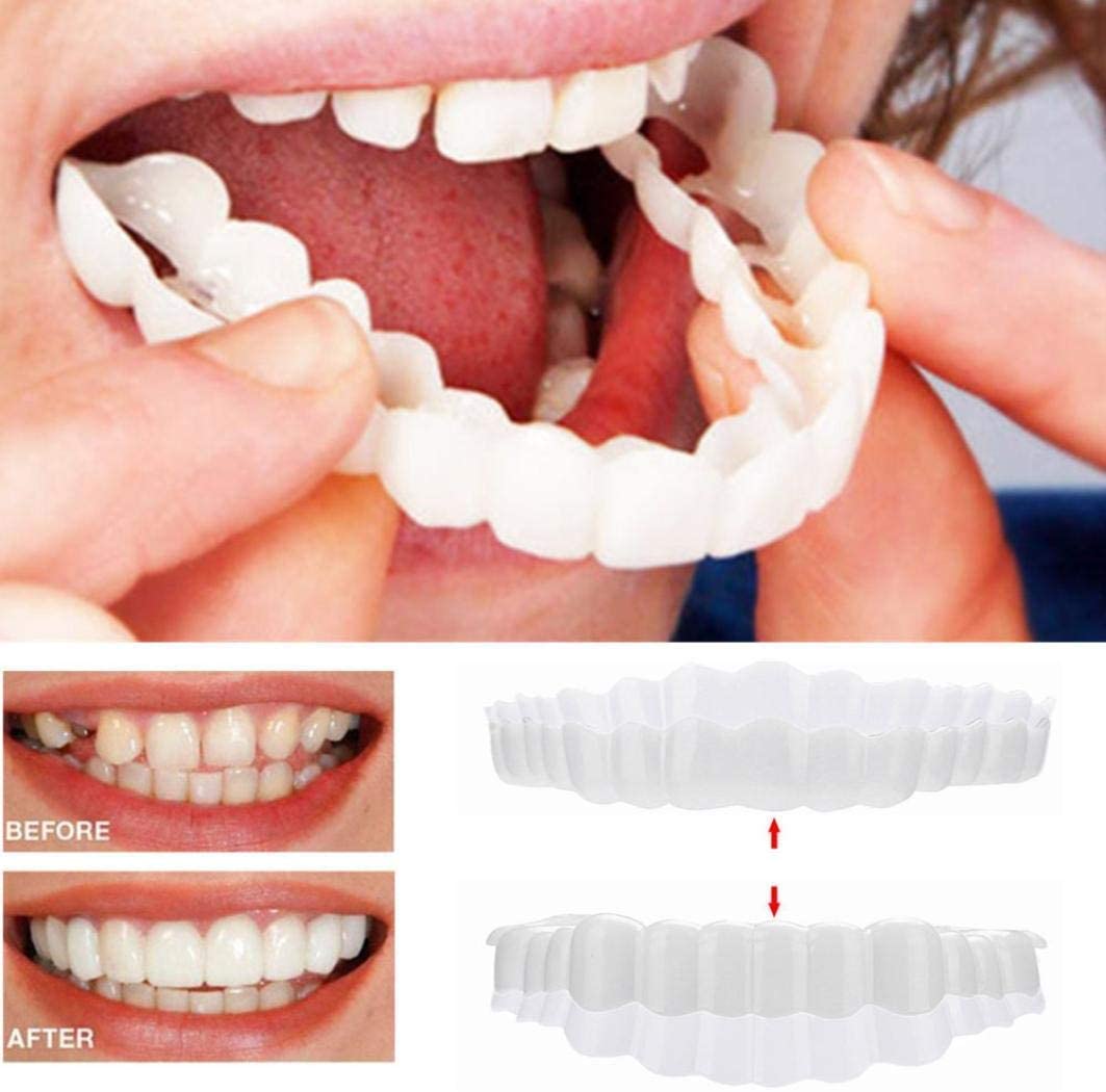 SMILEDURA – Upper and Lower Smile Veneer Set