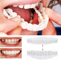 SMILEDURA – Upper and Lower Smile Veneer Set